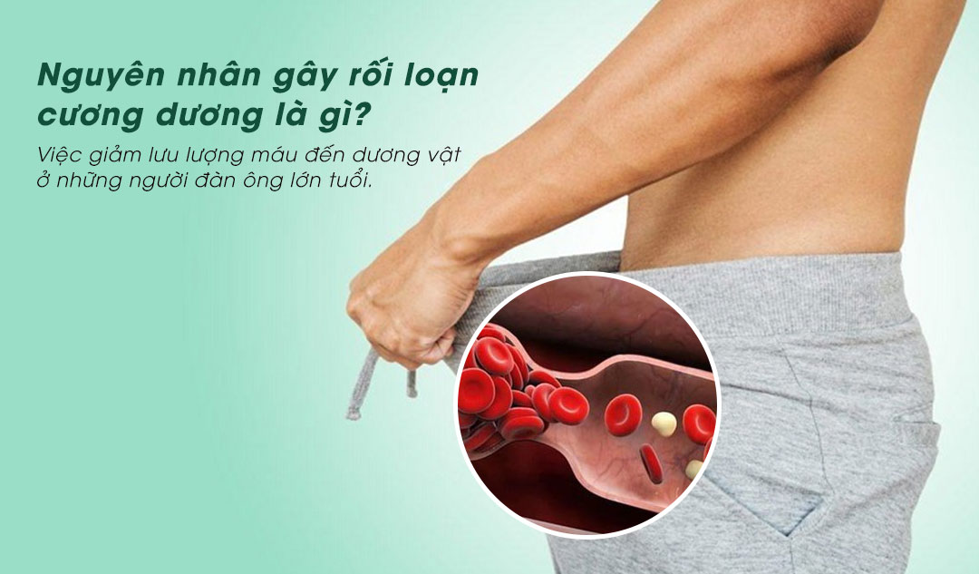 Nguyên nhân gây rối loạn cương dương là gì?