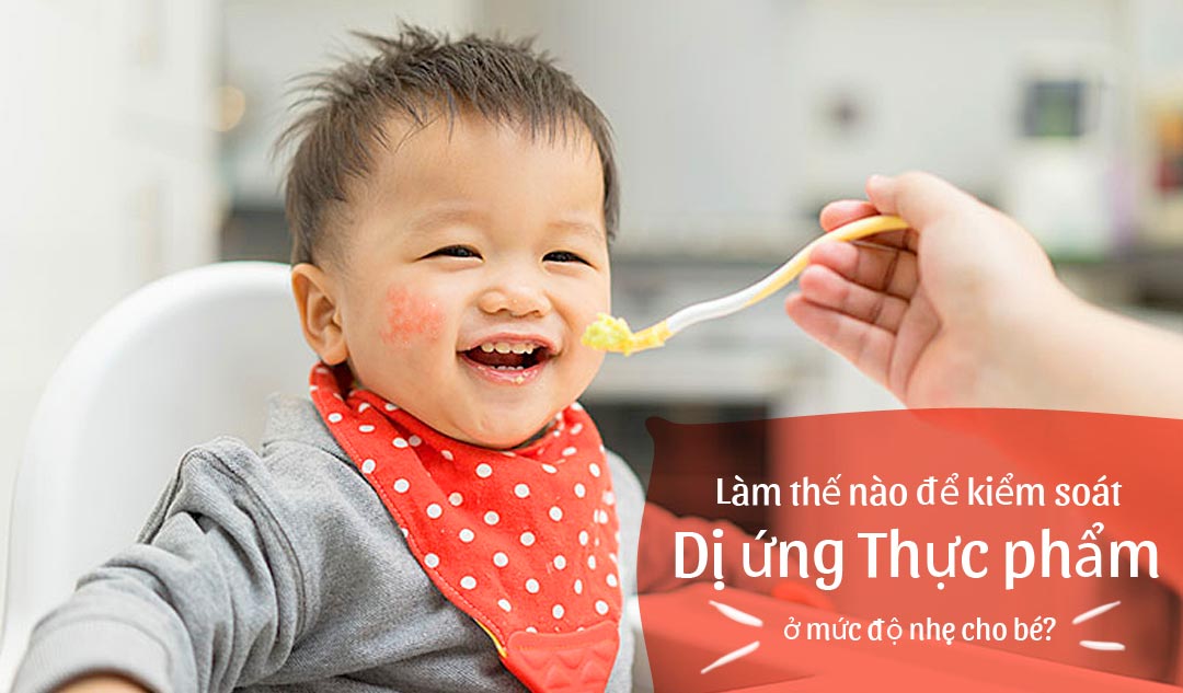 Làm thế nào để kiểm soát dị ứng thực phẩm ở mức độ nhẹ cho bé?