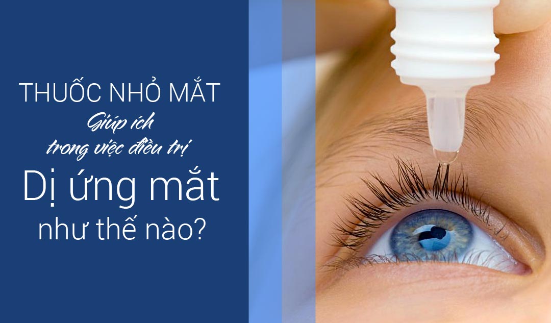 Thuốc nhỏ mắt có thể giúp ích trong việc điều trị dị ứng mắt như thế nào?