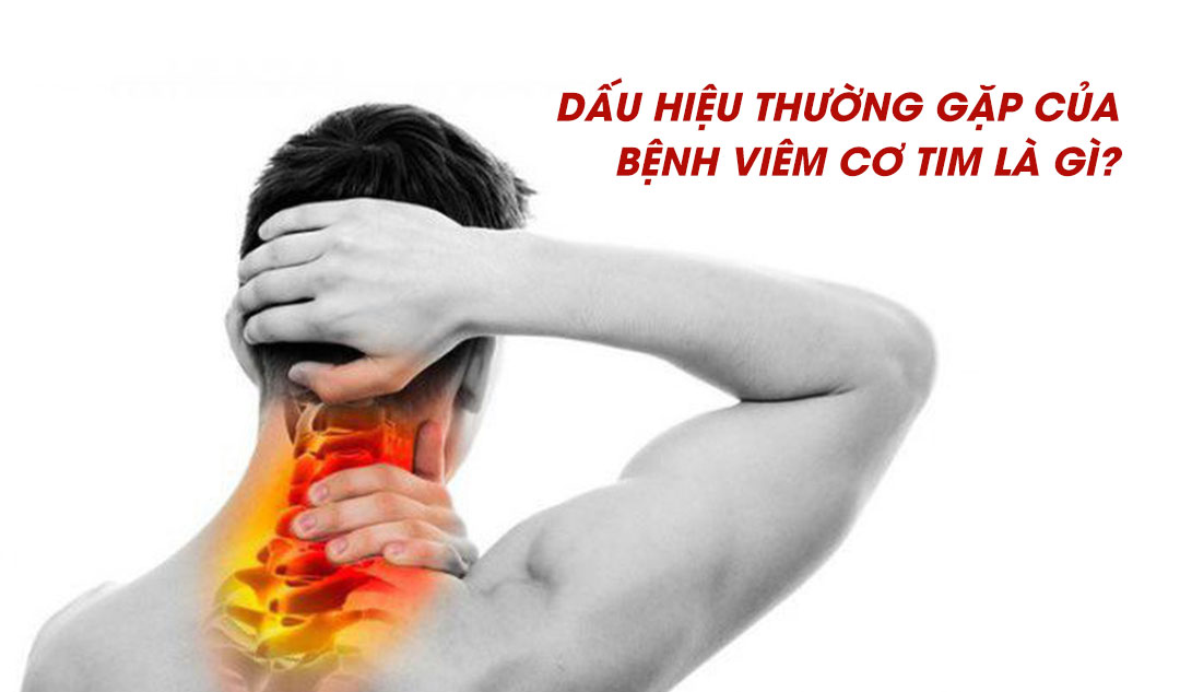 Dấu hiệu thường gặp của bệnh viêm cơ tim là gì?