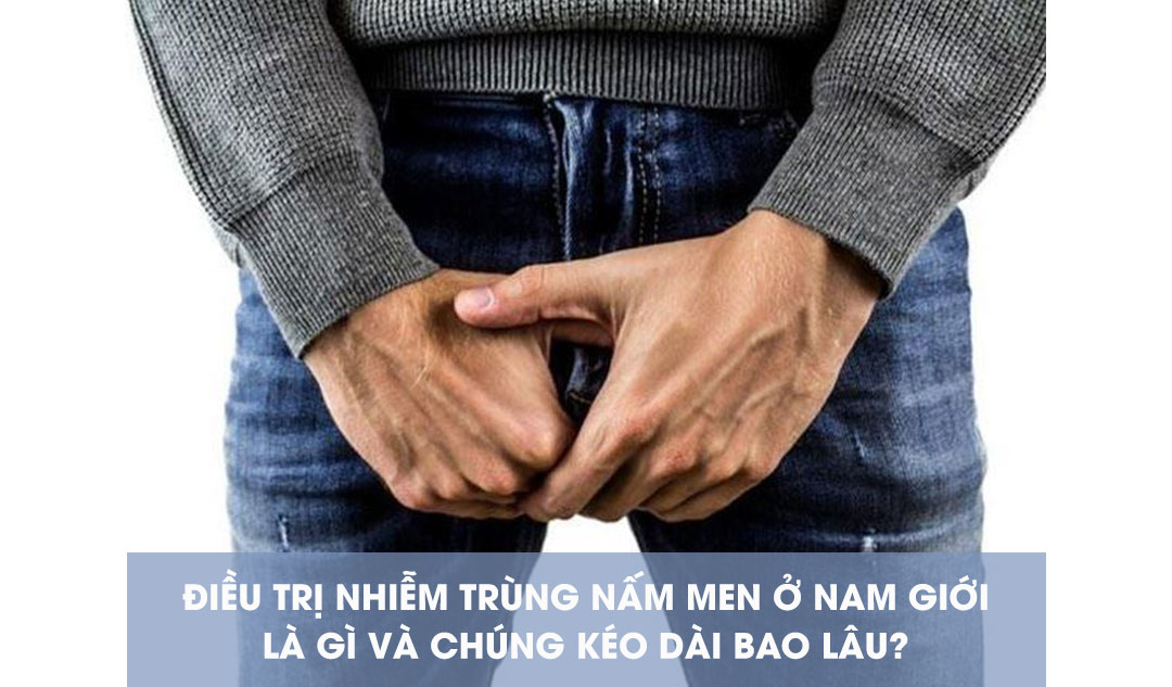 Điều trị nhiễm trùng nấm men ở nam giới là gì và chúng kéo dài bao lâu? 