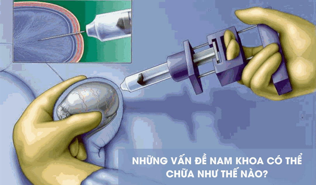 Những vấn đề nam khoa có thể chữa như thế nào?