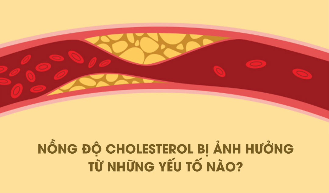 Nồng độ cholesterol bị ảnh hưởng từ những yếu tố nào?