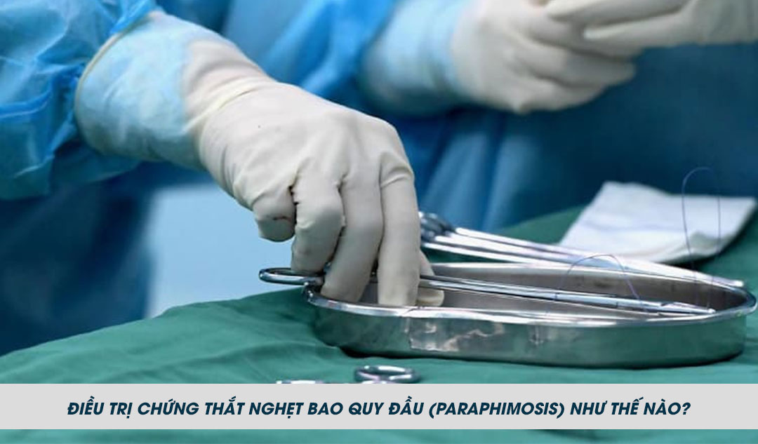 Điều trị chứng thắt nghẹt bao quy đầu (paraphimosis) như thế nào?