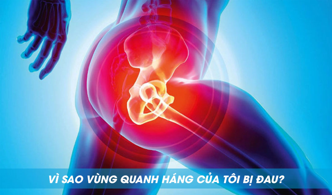 Vì sao vùng quanh háng của tôi bị đau?