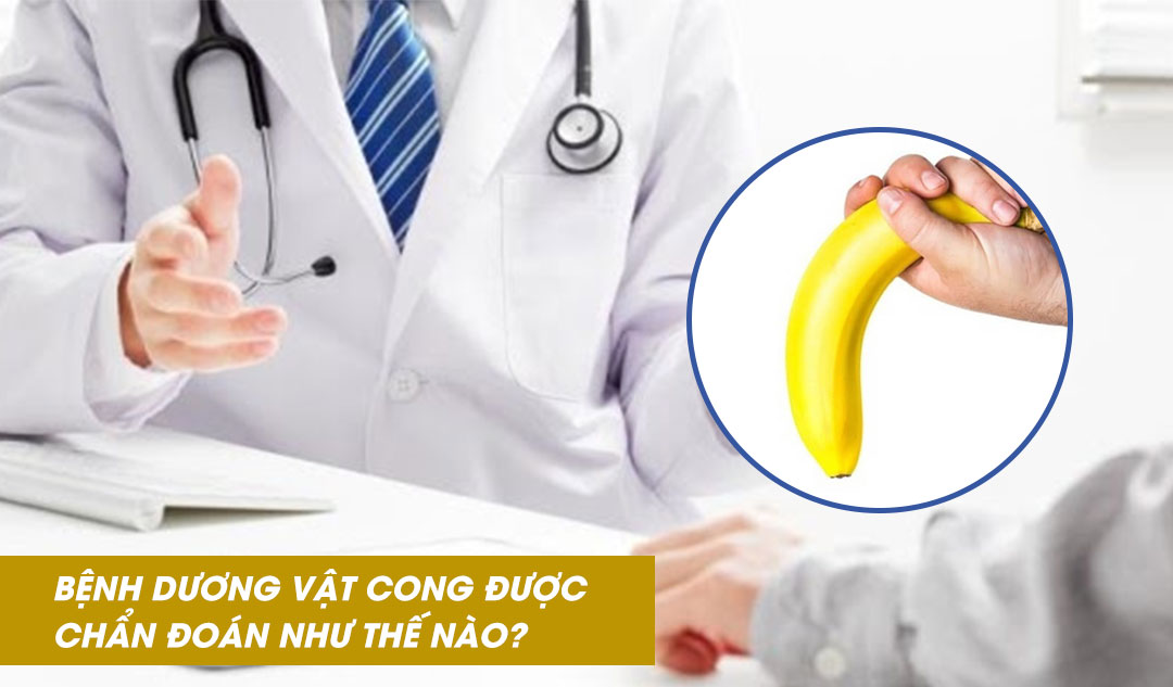 Bệnh dương vật cong được chẩn đoán như thế nào?