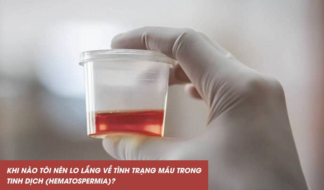 Khi nào tôi nên lo lắng về tình trạng máu trong tinh dịch (hematospermia)?