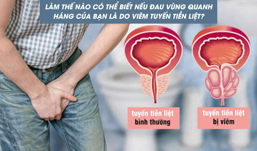 Làm thế nào có thể biết nếu đau vùng quanh háng của bạn là do viêm tuyến tiền liệt?