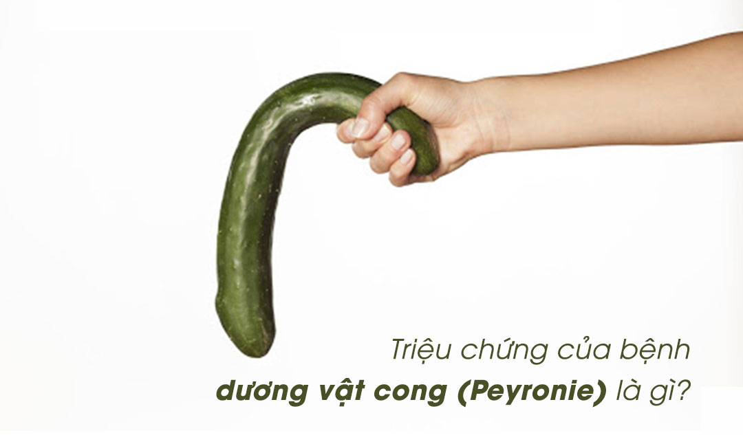 Triệu chứng của bệnh dương vật cong (Peyronie) là gì?