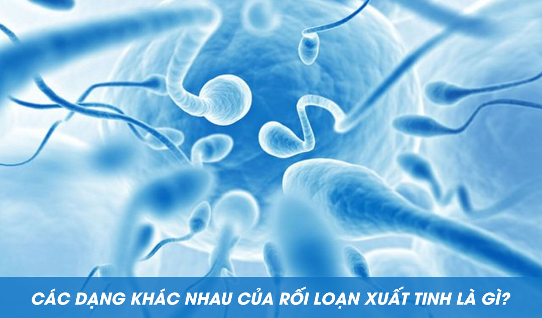 Các dạng khác nhau của rối loạn xuất tinh là gì?