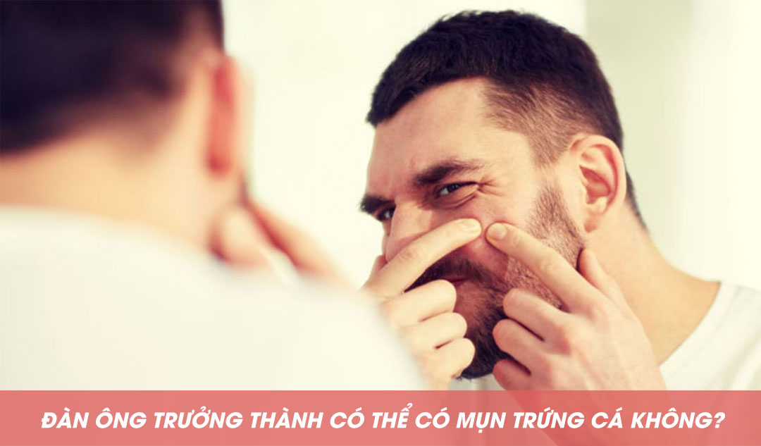 Đàn ông trưởng thành có thể có mụn trứng cá không?