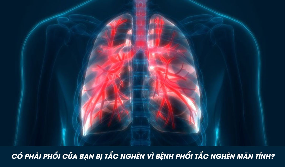 Có phải phổi của bạn bị tắc nghẽn vì bệnh phổi tắc nghẽn mãn tính?