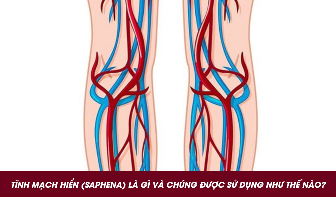 Tĩnh mạch hiển (saphena) là gì và chúng được sử dụng như thế nào?