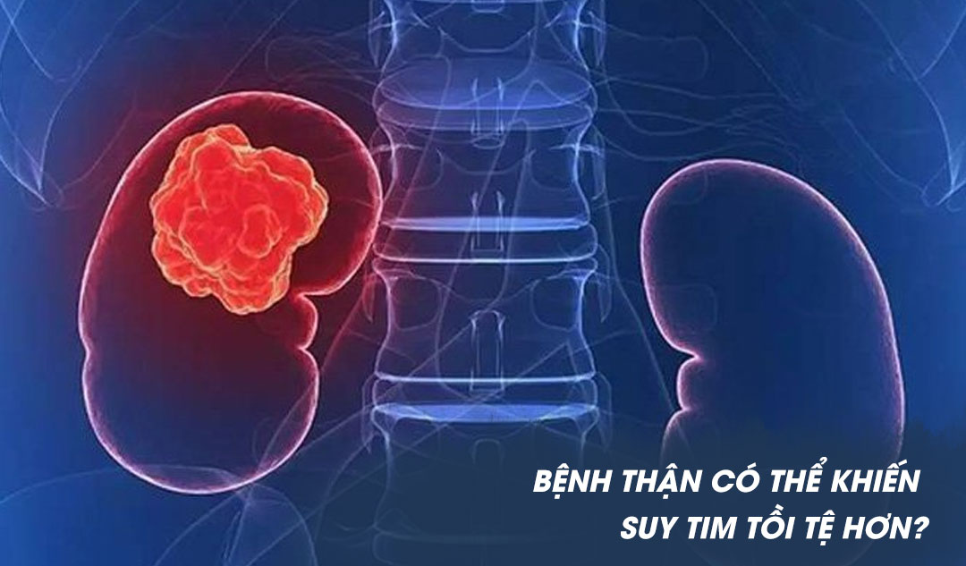 Bệnh thận có thể khiến suy tim tồi tệ hơn?