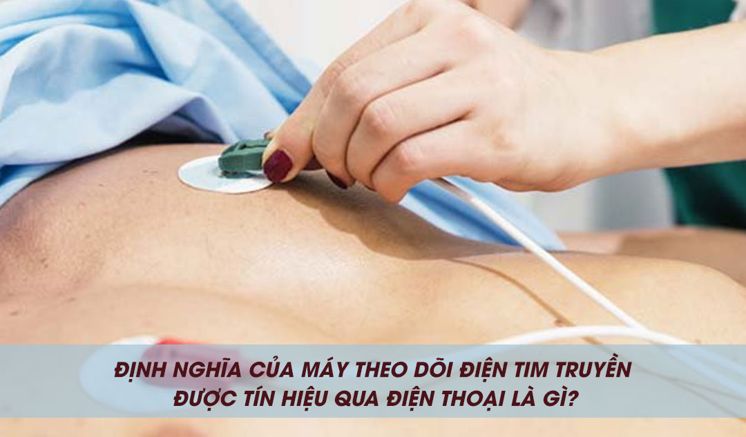 Định nghĩa của máy theo dõi điện tim truyền được tín hiệu qua điện thoại là gì?