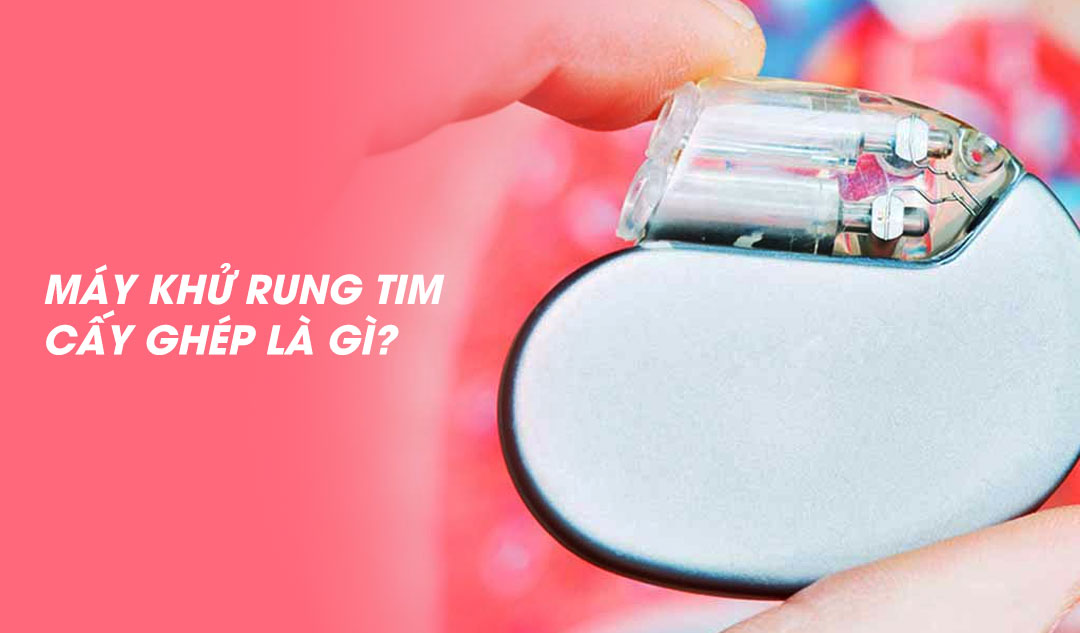 Máy khử rung tim cấy ghép là gì?