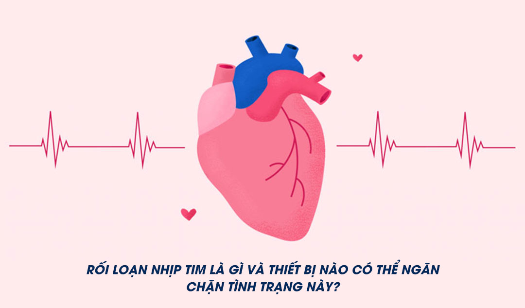 Rối loạn nhịp tim là gì và thiết bị nào có thể ngăn chặn tình trạng này?