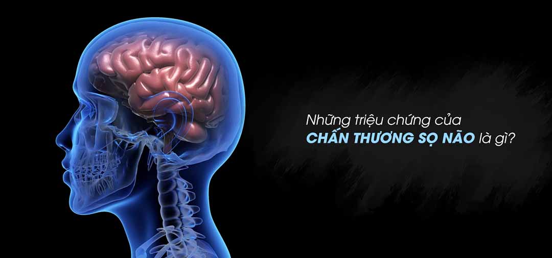 Những triệu chứng của chấn thương sọ não là gì?