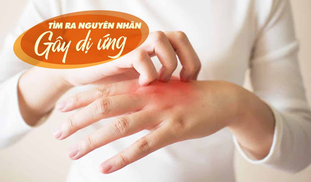 Làm thế nào tôi có thể tìm ra nguyên nhân gây dị ứng của tôi?