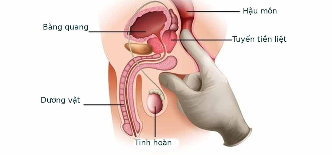 Tuyến tiền liệt nằm ở đâu trong cơ thể?