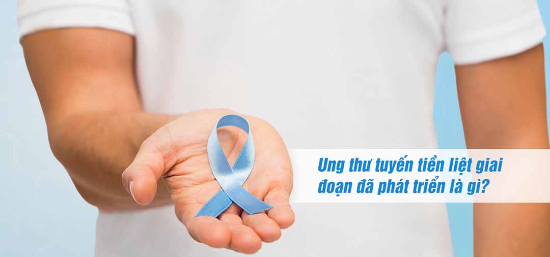 Ung thư tuyến tiền liệt giai đoạn đã phát triển là gì?