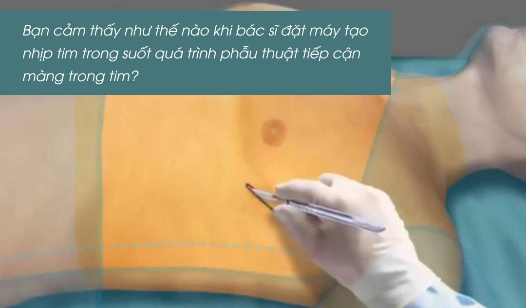 Bạn cảm thấy như thế nào khi bác sĩ đặt máy tạo nhịp tim trong suốt quá trình phẫu thuật tiếp cận màng trong tim?