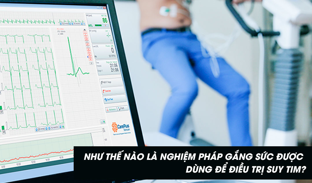 Như thế nào là nghiệm pháp gắng sức được dùng để điều trị suy tim?