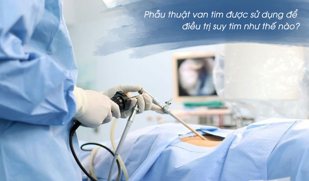 Phẫu thuật van tim được sử dụng để điều trị suy tim như thế nào?