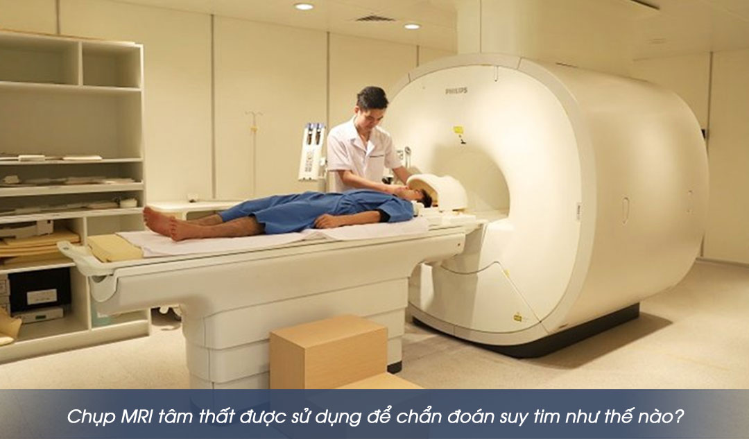 Chụp MRI tâm thất được sử dụng để chẩn đoán suy tim như thế nào?