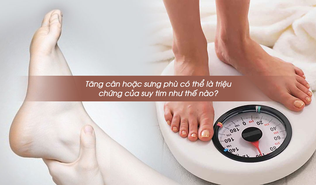 Tăng cân hoặc sưng phù có thể là triệu chứng của suy tim như thế nào?