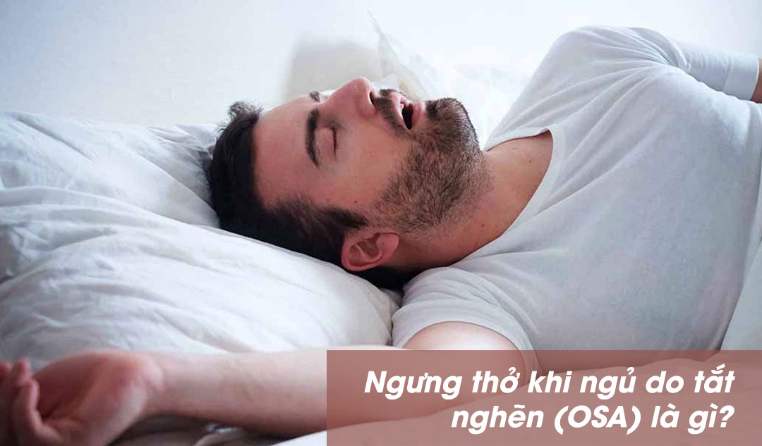  Ngưng thở khi ngủ do tắt nghẽn (OSA) là gì?