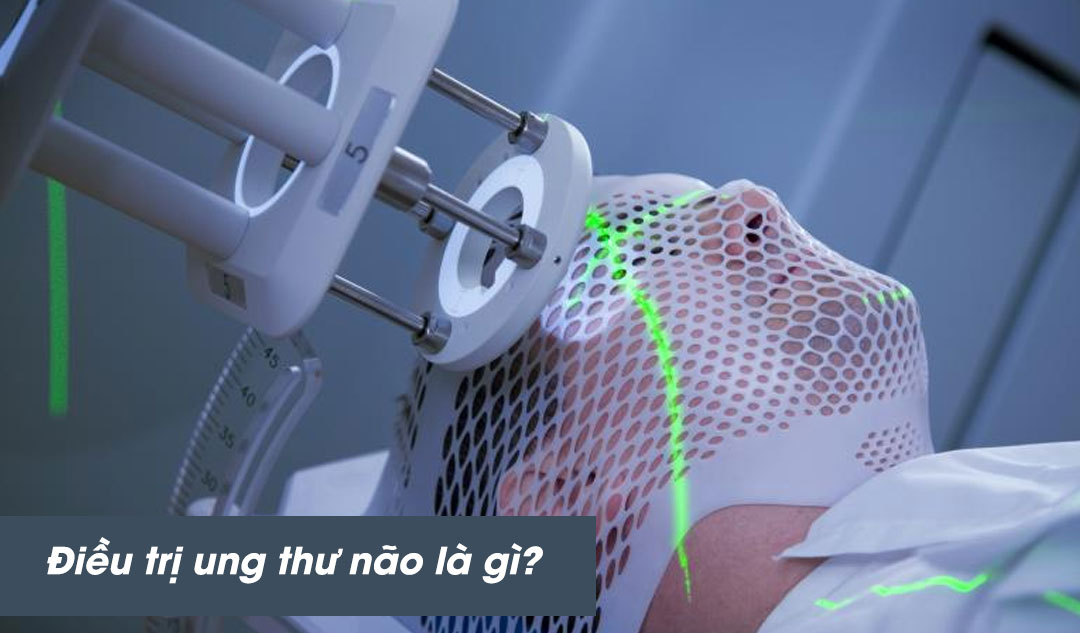 Điều trị ung thư não là gì?