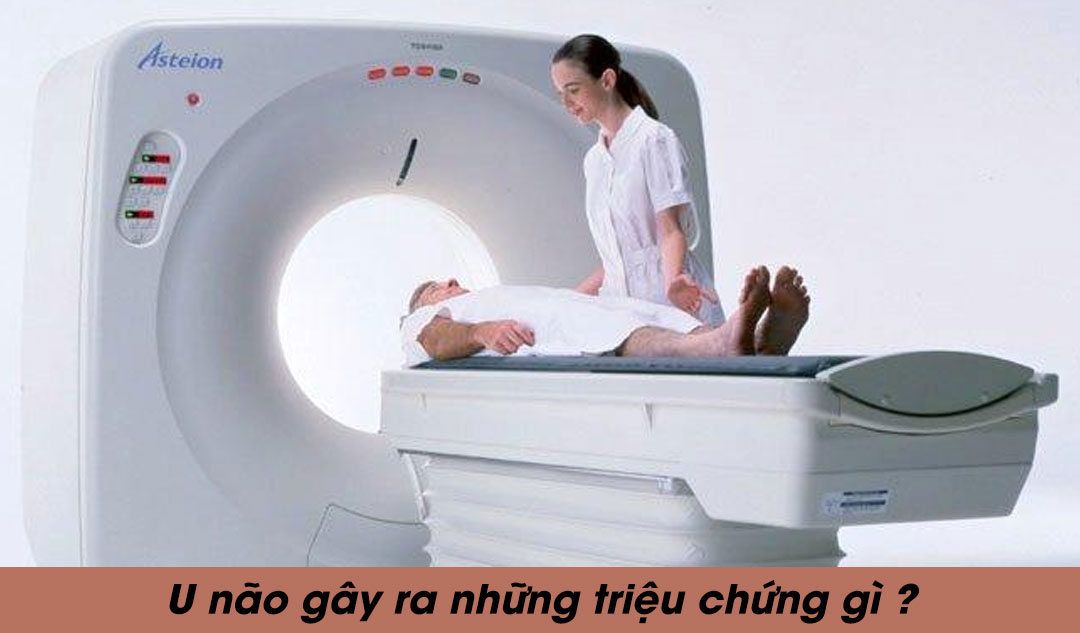 U não gây ra những triệu chứng gì ?