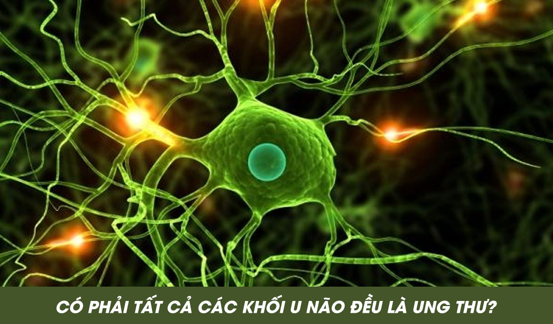 Có phải tất cả các khối u não đều là ung thư ?