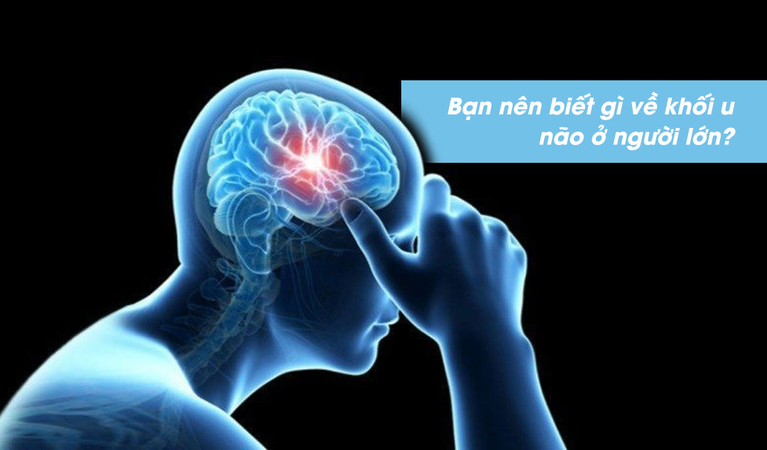 Bạn nên biết gì về khối u não ở người lớn?