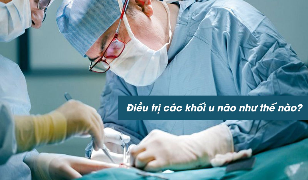 Điều trị các khối u não như thế nào ?