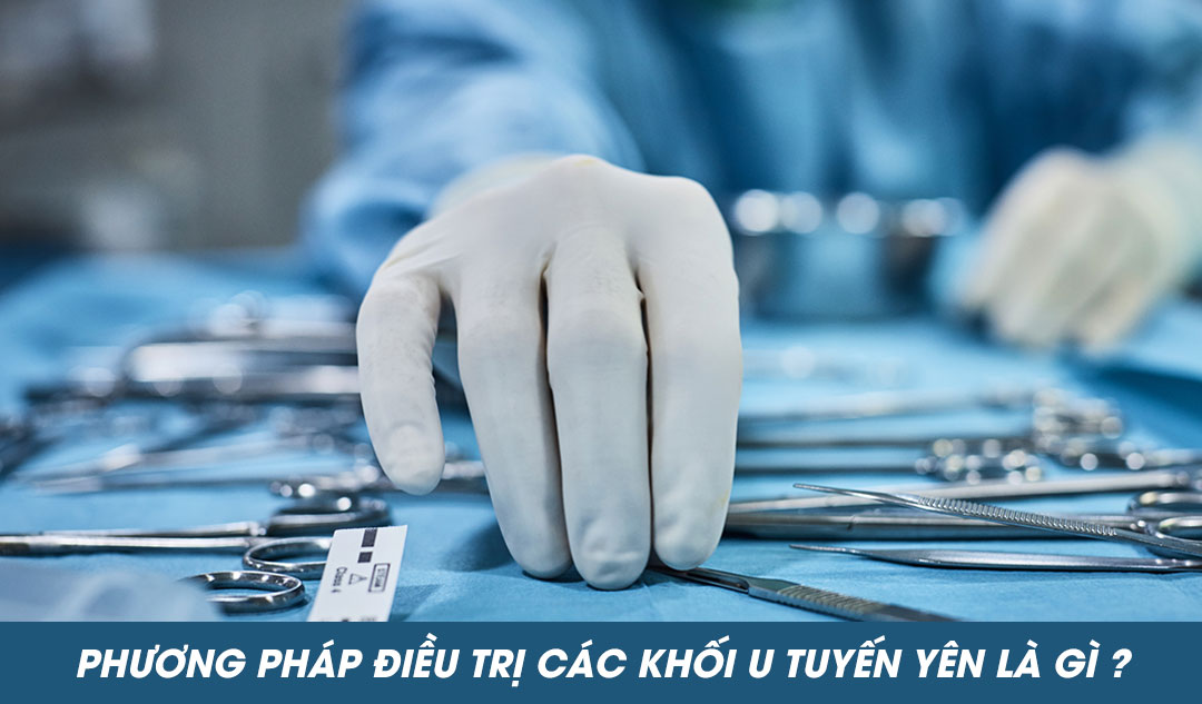 Phương pháp điều trị các khối u tuyến yên là gì ?