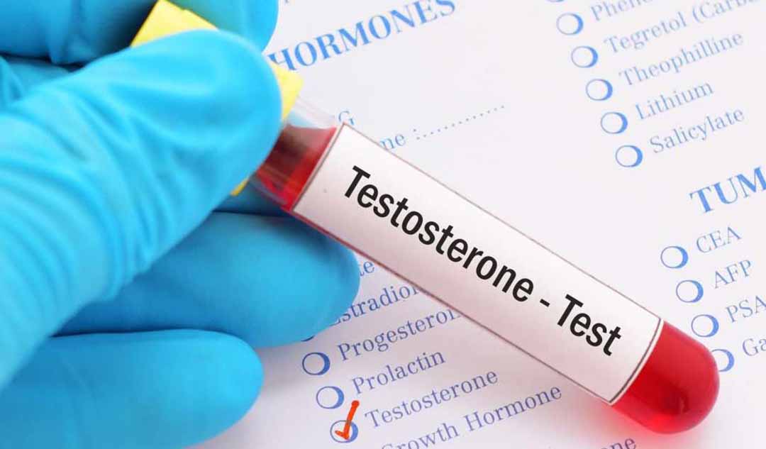 Làm thế nào để tôi biết nếu tôi có testosterone thấp?