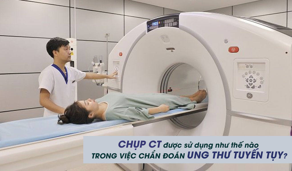 Chụp CT được sử dụng như thế nào trong việc chẩn đoán ung thư tuyến tụy?
