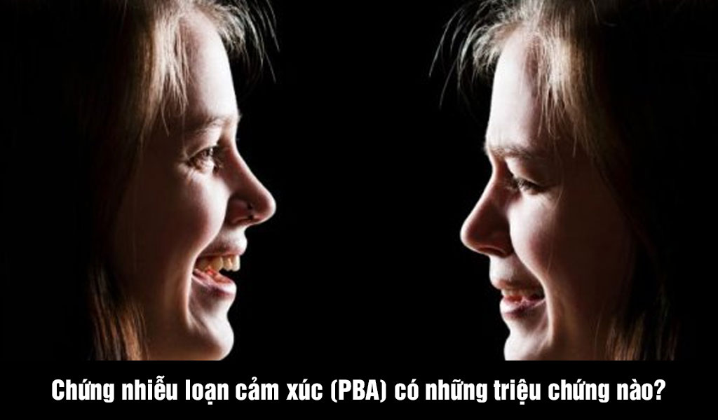 Chứng nhiễu loạn cảm xúc (PBA) có những triệu chứng nào?