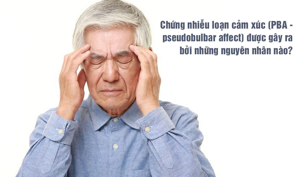 Chứng nhiễu loạn cảm xúc (PBA - pseudobulbar affect) được gây ra bởi những nguyên nhân nào?