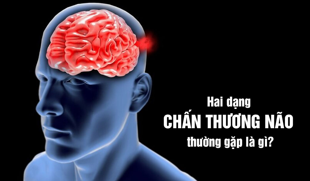 Hai dạng chấn thương não thường gặp là gì?