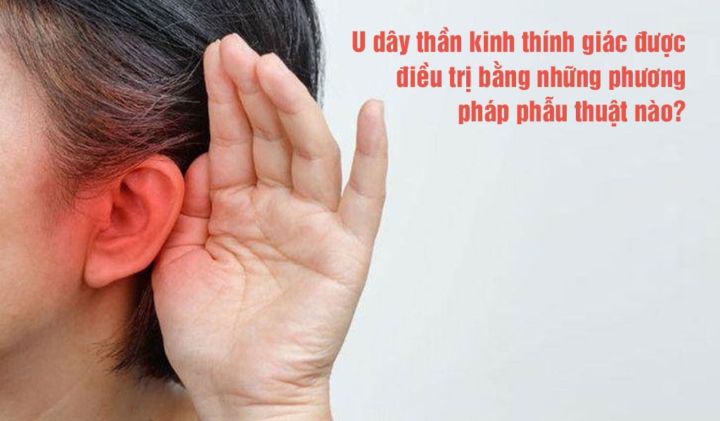 U dây thần kinh thính giác được điều trị bằng những phương pháp phẫu thuật nào?