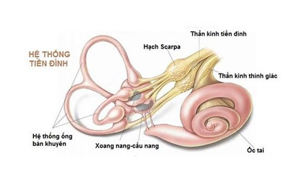 Hội chứng hở ống bán khuyên là gì?