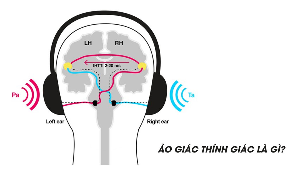Ảo giác thính giác là gì?