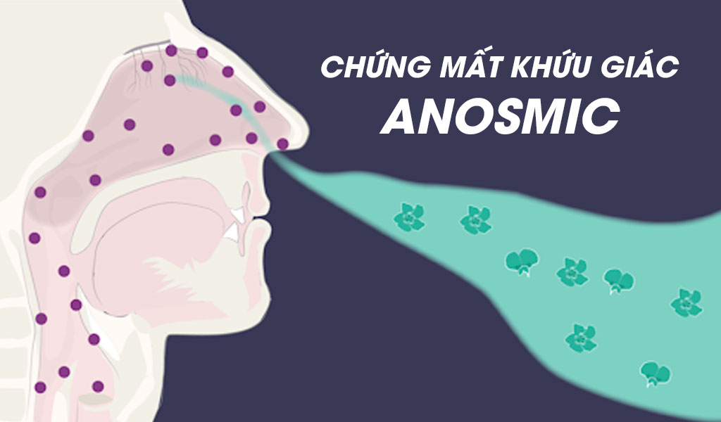 Chứng mất khứu giác anosmic được chẩn đoán như thế nào?