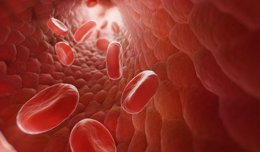 Triển vọng của bệnh đa hồng cầu là gì?