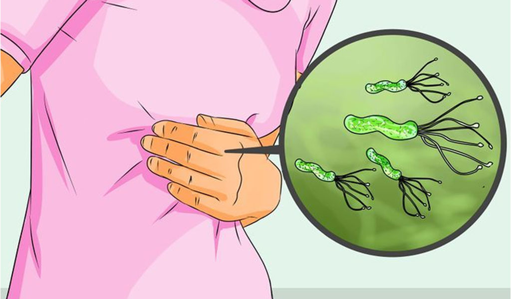 Nhiễm khuẩn Helicobacter pylori (H. pylori) có những triệu chứng gì?