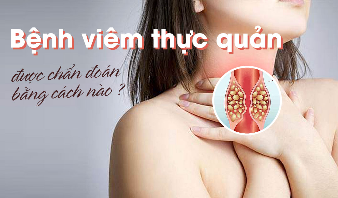 Bệnh Viêm thực quản được chẩn đoán bằng cách nào?