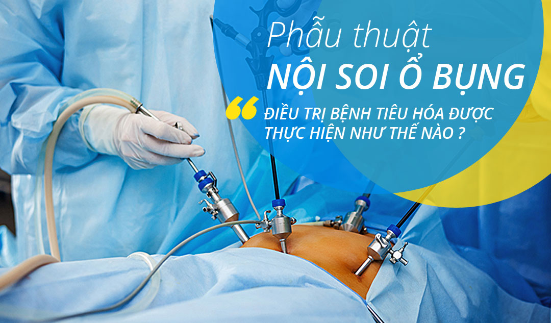 Phẫu thuật nội soi ổ bụng điều trị bệnh tiêu hóa được thực hiện như thế nào?